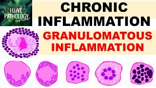 Systemic effects of inflammation [upl. by Eiramave]