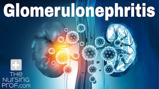 Renal Emergencies Glomerulonephritis [upl. by Ynavoj]