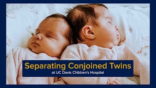 Separating Conjoined Twins at UC Davis Childrens Hospital [upl. by Ydnih988]