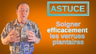 ASTUCE  Extraire EFFICACEMENT une verrue plantaire [upl. by Aissilem]