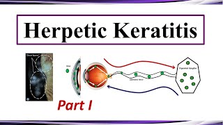 Herpetic Keratitis  Pathogenesis and Clinical Presentation Part I [upl. by Pattin]