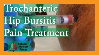 HipTrochanteric Bursitis Watch This [upl. by Nibur]