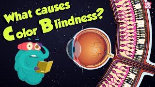 What Causes Color Blindness  WhatIs COLOR BLINDNESS  Dr Binocs Show  Peekaboo Kidz [upl. by Zacharie818]