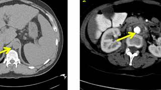 Introduction to Radiology Conventional Radiography [upl. by Octavie]