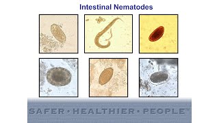 Diagnostic Features of Intestinal Nematodes [upl. by Huan362]