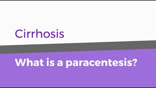 Cirrhosis – What is a paracentesis [upl. by Aix66]