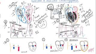 Restrictive vs Constrictive cardiomyopathy [upl. by Lehte]