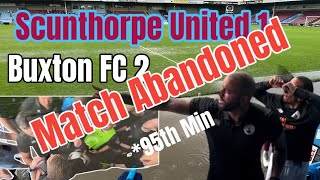 Scunthorpe United AA Buxton FC [upl. by Surtimed]