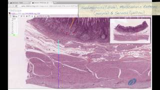 Histology Helper  Digestive System II Histology [upl. by Bonilla]