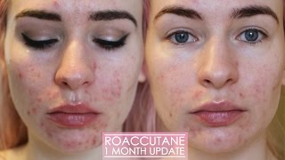 1 MONTH ROACCUTANE UPDATE  Side effects amp my skin now [upl. by Elletsirk]