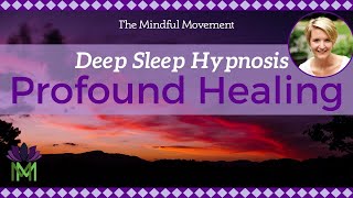 Use Your Powerful Mind Healing Deep Sleep Hypnosis  Mindful Movement [upl. by Keare550]