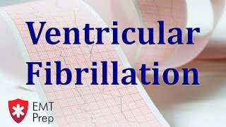 Ventricular Fibrillation ECG  EMTprepcom [upl. by Berri451]