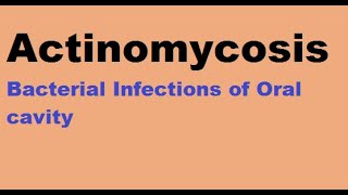 Actinomycosis  Bacterial infections of the oral cavity [upl. by Fischer64]