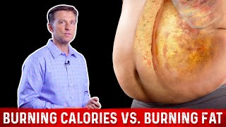 Burning Calories vs Burning FAT Calories – Dr Berg [upl. by Ochs]