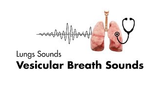 Vesicular Breath Sounds  Normal Lung Sounds  MEDZCOOL [upl. by Ennasus]