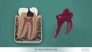 Endodontic treatments [upl. by Indnahc462]