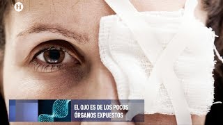 Lesiones comunes en los ojos ¿cómo evitarlas o tratarlas [upl. by Rip]