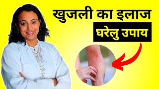 Itchy Skin Treatment in Hindi  Home Remedies [upl. by Ainit365]