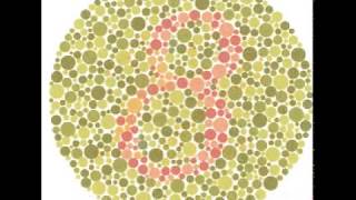 Test for Colour Blindness [upl. by Buddie]