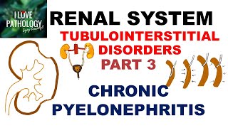 CHRONIC PYELONEPHRITIS  PATHOLOGY [upl. by Silvie322]