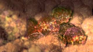 Cancer Cells Undergoing Mitosis [upl. by Iline505]