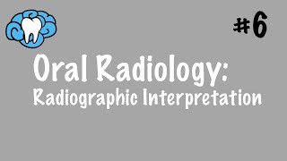 Oral Radiology  Radiographic Interpretation  INBDE ADAT [upl. by Dam528]