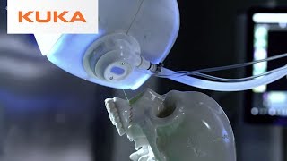 KUKA Medical Robotics  The Future of Medicine [upl. by Aryaz569]