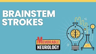 Brainstem Stroke Mnemonics Memorable Neurology Lecture 15 [upl. by Curtice142]