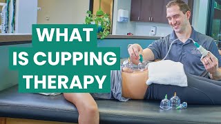 Cupping Therapy How It Works [upl. by Nylesoj694]