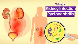 What Is Kidney Infection Pyelonephritis The Definitive Guide [upl. by Darla]