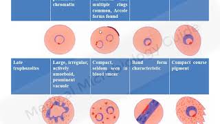 Laboratory diagnosis of Malaria lecture [upl. by Anauj784]