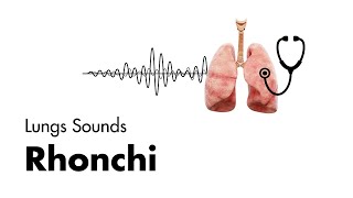 Rhonchi  Lung Sounds  Medzcool [upl. by Boony717]