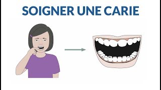 Comment soigner une dent cariée [upl. by Raseta]