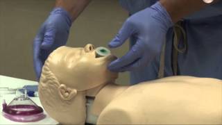 Airway Management [upl. by Duffie]