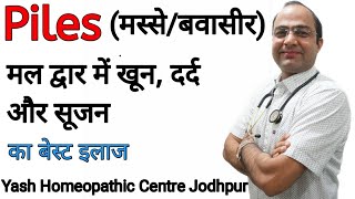 Piles Bleeding best treatment खूनी बवासीर का ईलाज । [upl. by Enaoj]