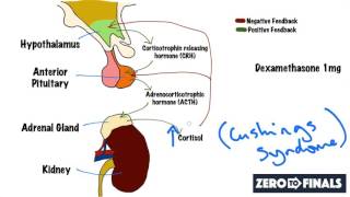 Understanding The Dexamethasone Suppression Test [upl. by Sharon]