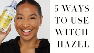 5 Ways to Use Witch Hazel  Witch Hazel Skincare  Acne Benefits [upl. by Ecnadnac]