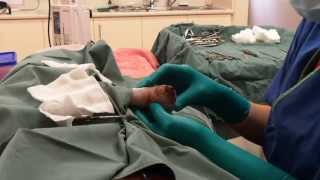 Veterinary Education Dog Leg Lump Removal [upl. by Guido]