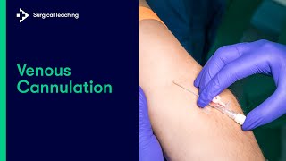 Intravenous IV Cannulation  An Essential Guide [upl. by Alphonso]