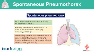 Spontaneous Pneumothorax Causes Clinical features Pathophysiology and Diagnosis [upl. by Vescuso]