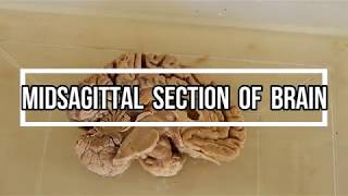 Midsagittal Section of Brain  neuroanatomy [upl. by Koa]