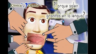 👅Granitos En La Lengua👅 Clínica Dental Velez  Erick velez [upl. by Kassie]