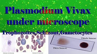 Plasmodium Vivax under microscope TrophozoitesSchizontGametocytesclear explain [upl. by Nnylyrehc280]