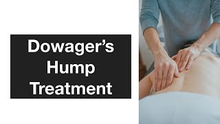 Dowagers Hump Treatment [upl. by Farra909]