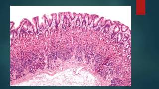 HISTOLOGIA DEL ESTOMAGO [upl. by Ahsinan]