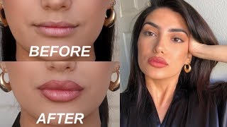 HOW TO FAKE BIG LIPS IN 3 EASY STEPS OMG [upl. by Shepley558]