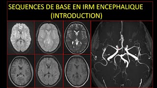 Séquences de base en IRM encéphalique Introduction [upl. by Ferris781]