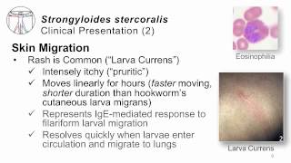 Helminths Strongyloides [upl. by Rhiana541]