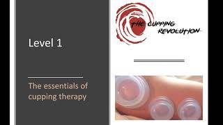 Essentials of Cupping Therapy Free Training [upl. by Alit]