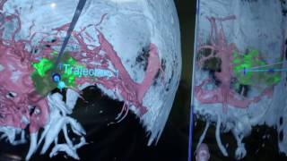 NOSE AND PARANASAL SINUSES  ANATOMY  SIMPLIFIED [upl. by Grishilda483]